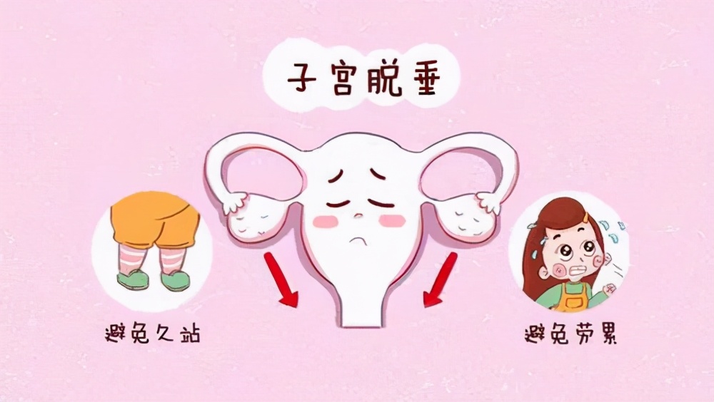 孕妇子宫脱垂感觉有东西掉出来,南宁子宫脱垂孕妇