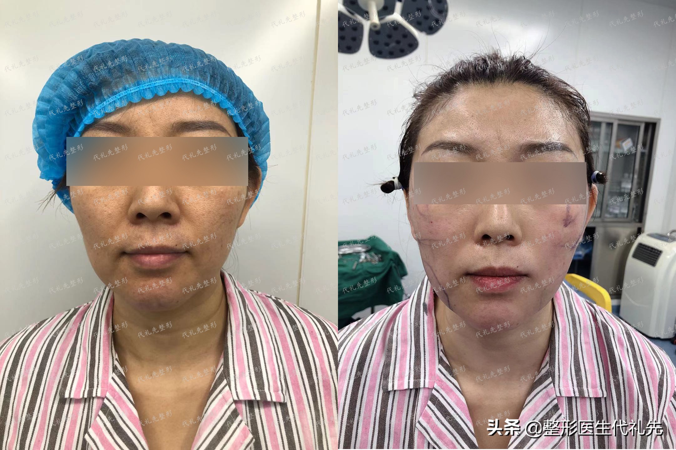 五大烂脸保养方法,垮脸的4大表现