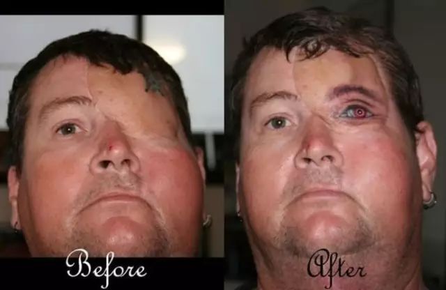 用纹身掩盖自己的伤疤,纹身是为了掩盖伤疤