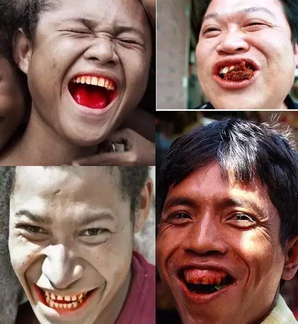 现实生活中槟榔的危害口腔癌患者,嚼槟榔真的会导致口腔癌吗