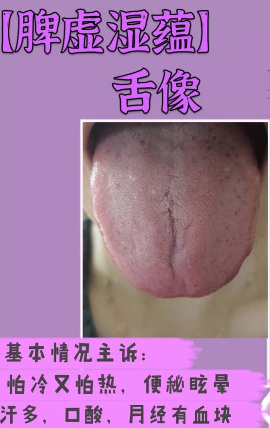 脾胃虚健脾胃的中药,十种健脾胃的中成药该如何调理