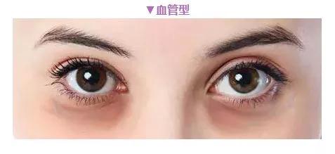 眼霜都是骗局吗视频,眼霜误区99%的人不知道