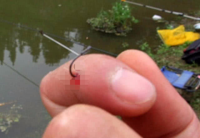 钓鱼鱼钩进喉咙里怎么办,野外钓鱼鱼钩刺入手指怎么办
