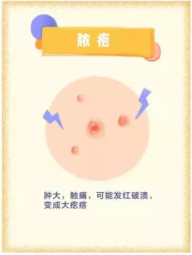 痘印痘坑痘痕去医院可以治好吗,防止痘坑的最好方法