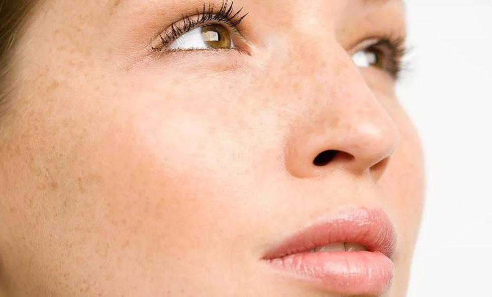 女人脸上有斑点是怎么回事,50岁女人脸上有斑点怎么消除