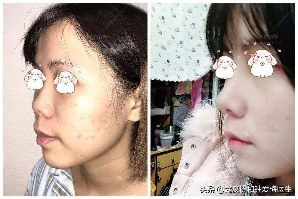 什么样的鼻子好看图片,男生什么样的鼻子最好看