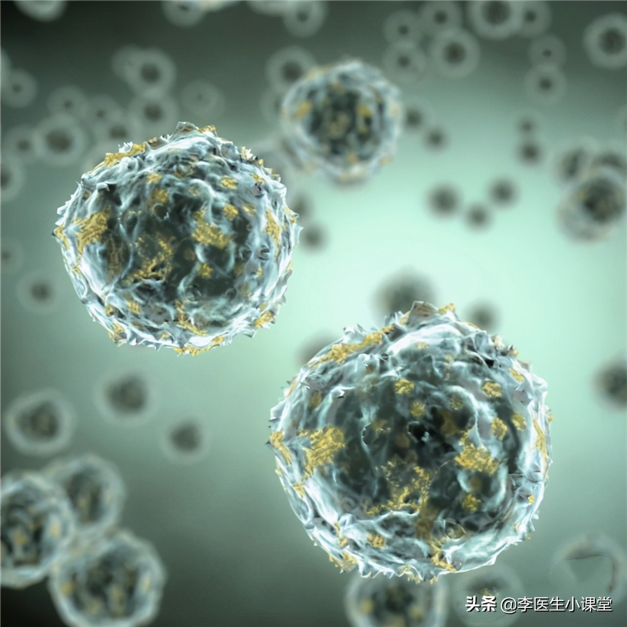 炎症有可能发展成癌症吗,从炎症到癌症每一步