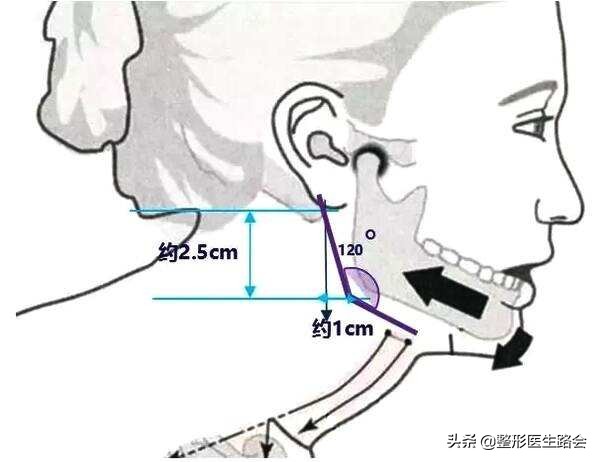 120度的下颌角容易变成方形脸吗,90度下颌角看着好难看啊