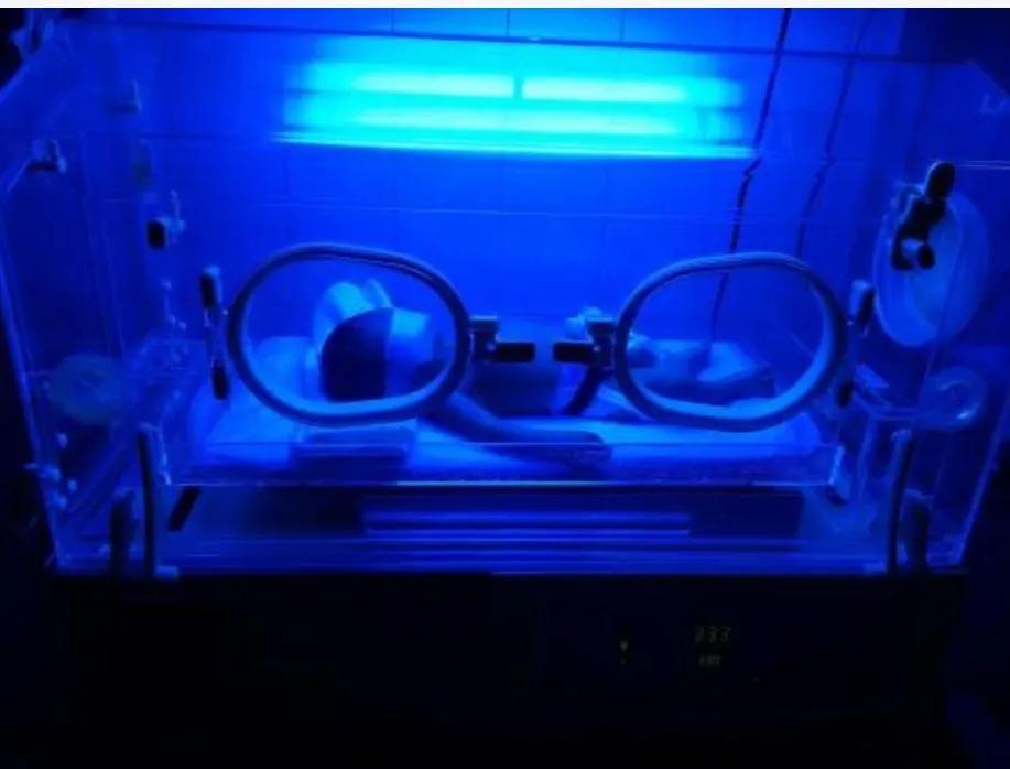 新生儿常见若干问题及解决办法|实用篇