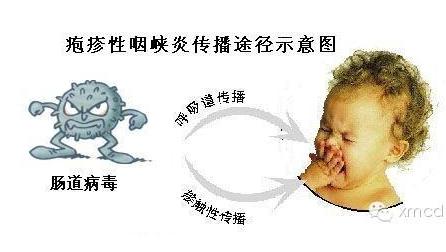宝宝得疱疹性咽峡炎怎么办,疱疹性咽峡炎和手足口区别