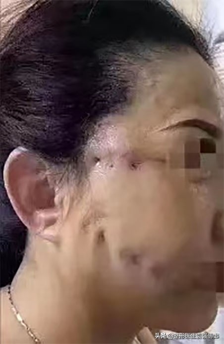 听医美专家讲座后的感想,听医生话对身体有什么危害