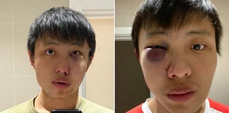 新加坡留学生在伦敦街头被暴打,新加坡留学生在伦敦被暴打事件