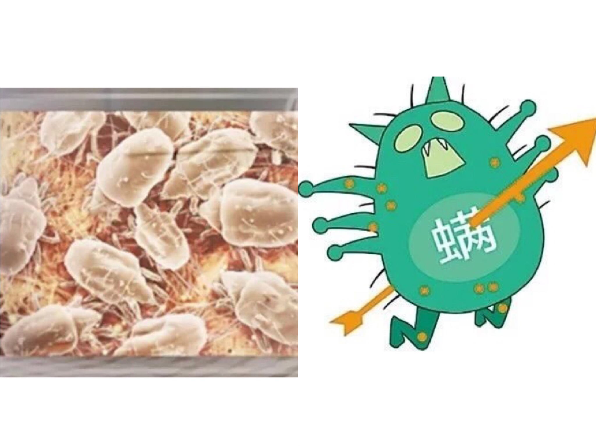 除螨大作战螨虫,除螨大作战让你告别螨虫