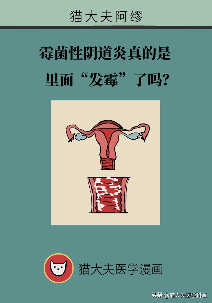 霉菌性阴道炎真的是里面“发霉”了吗？药师教你“抗霉”*法大**
