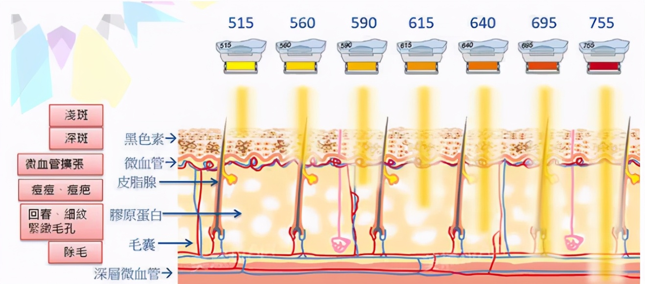 医美cc光子嫩肤仪器,医美光子嫩肤要做几次