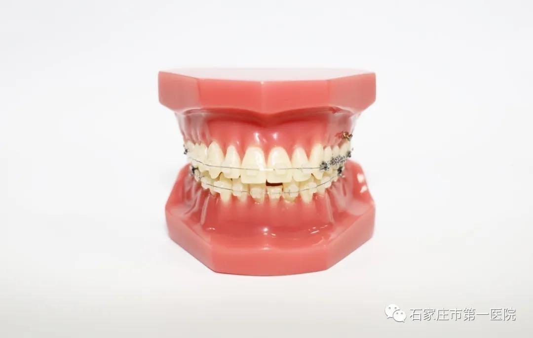 埋伏牙长出来的机遇大不大,埋伏牙初露头