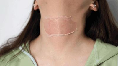 解决黑头的2种药,解决黑头的最好方法