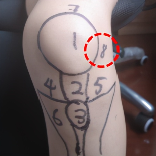 不同膝盖疼痛是暗示什么,不同位置的膝盖疼