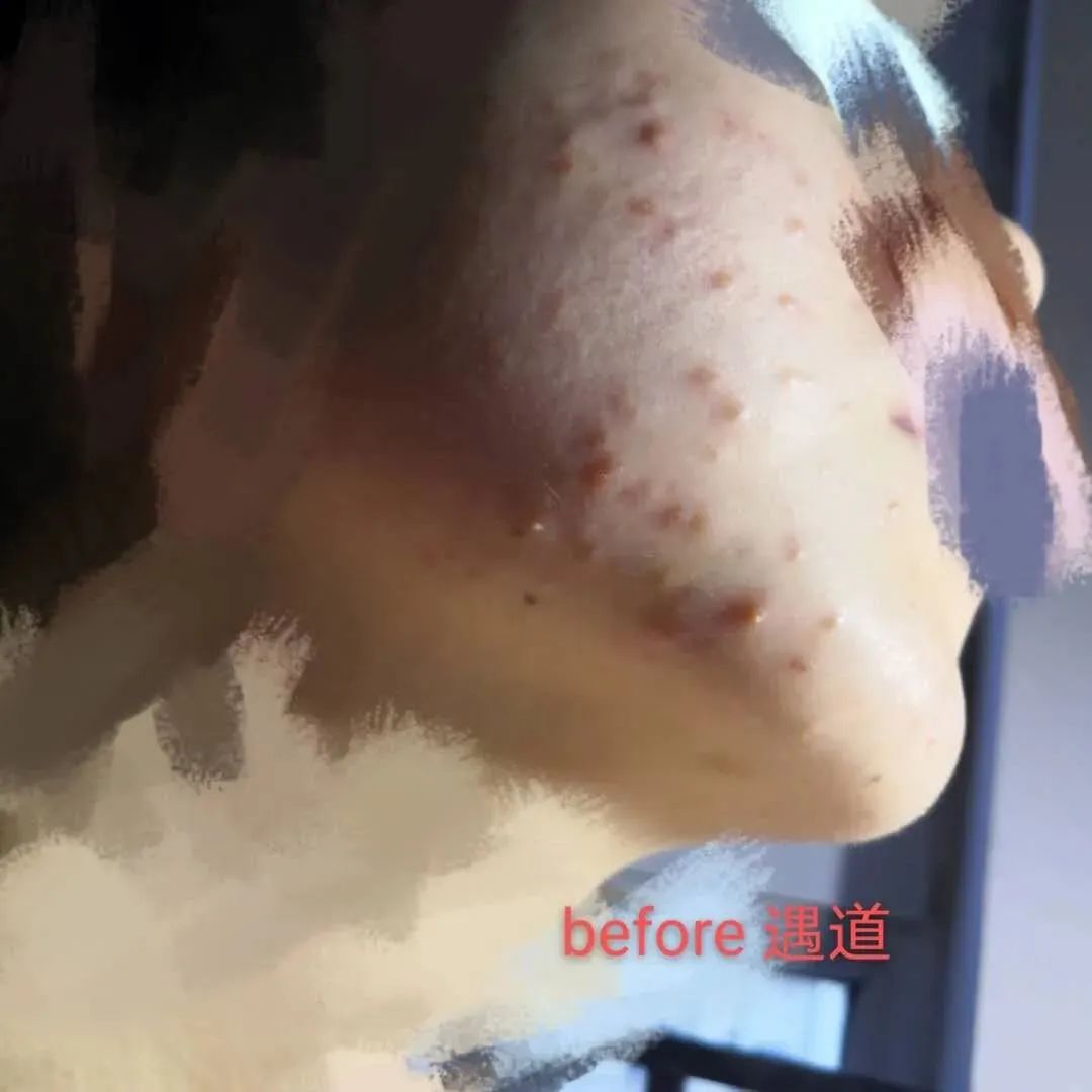 用大牌化妆品真的不会老吗,用大牌护肤品皮肤还是不好