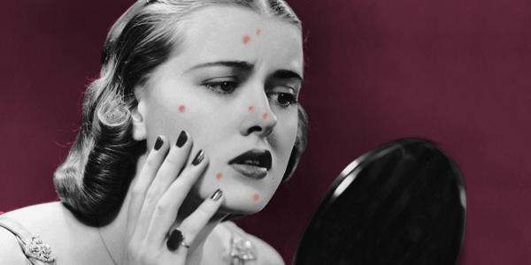 腋下痘痘挤出白色米粒是什么,痘痘里面挤出小米粒是不是就好了