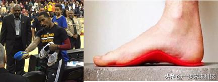 生物力学定制鞋垫,生物力学矫形鞋垫定制系统