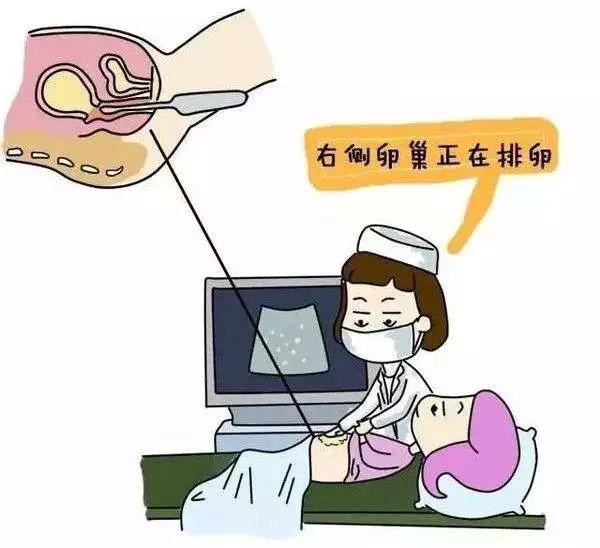 卵泡监测，到底有多重要？