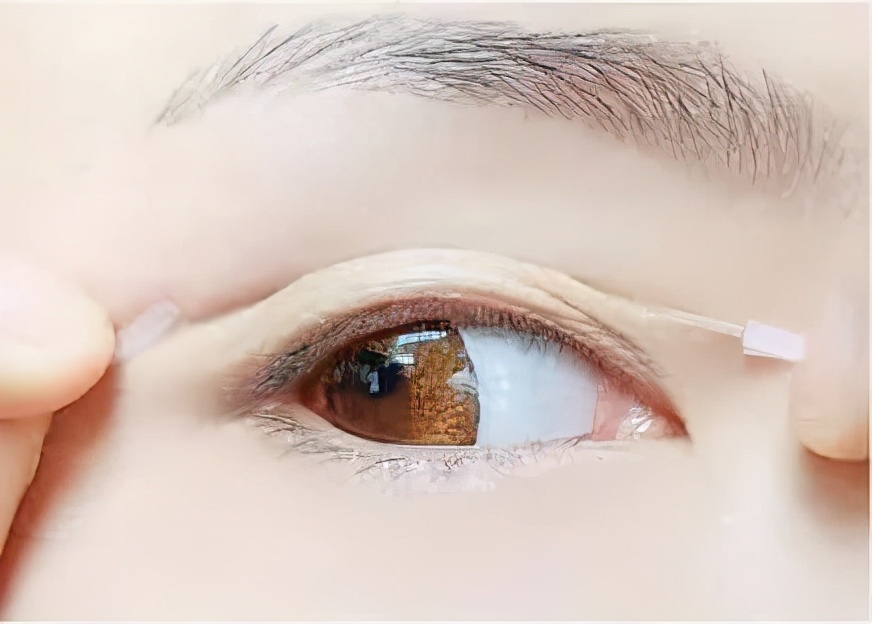 下眼皮下垂是什么原因导致的,一只眼皮下垂什么原因