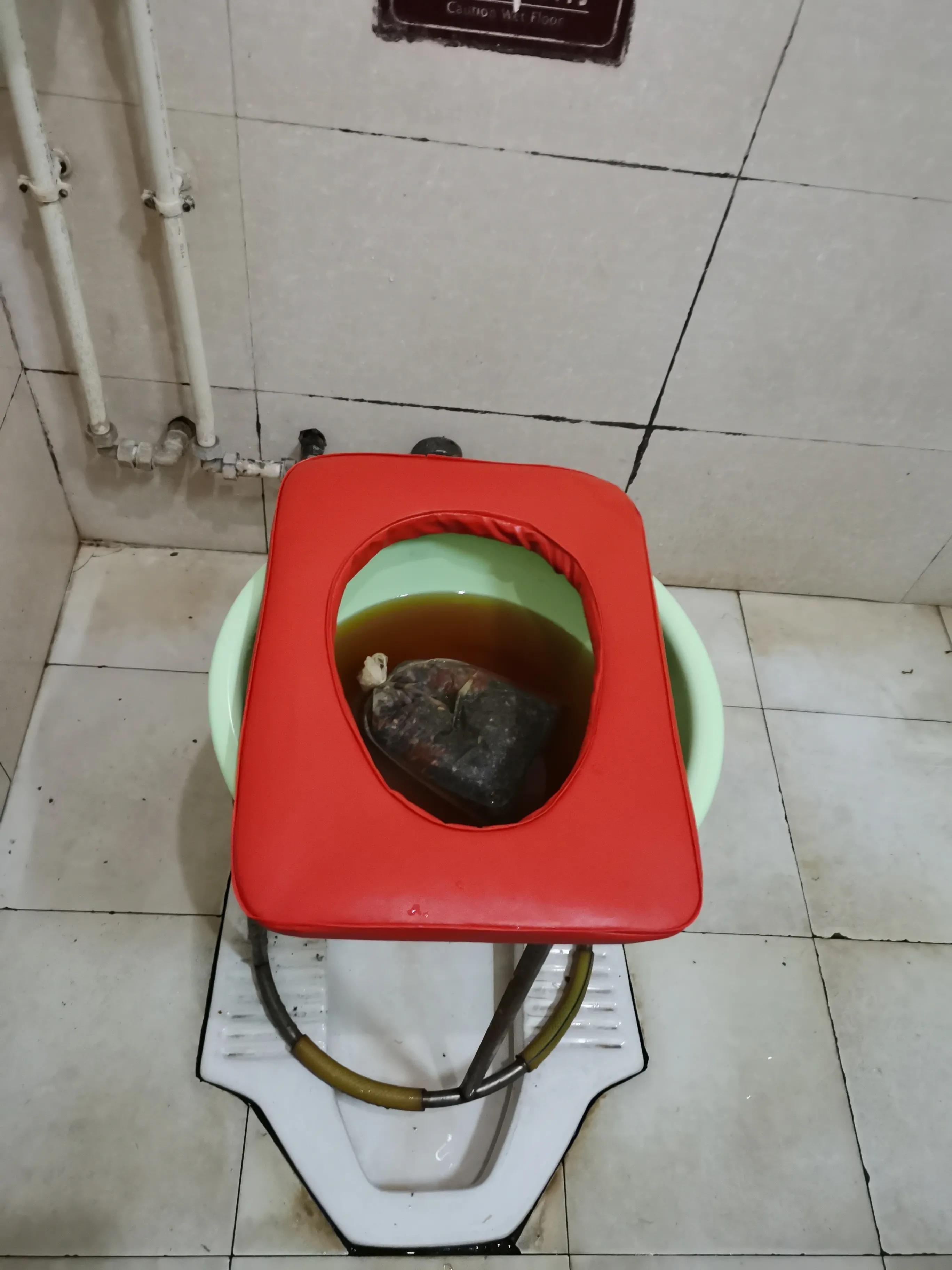 保守解决肛瘘的过程,肛瘘自愈日记50字