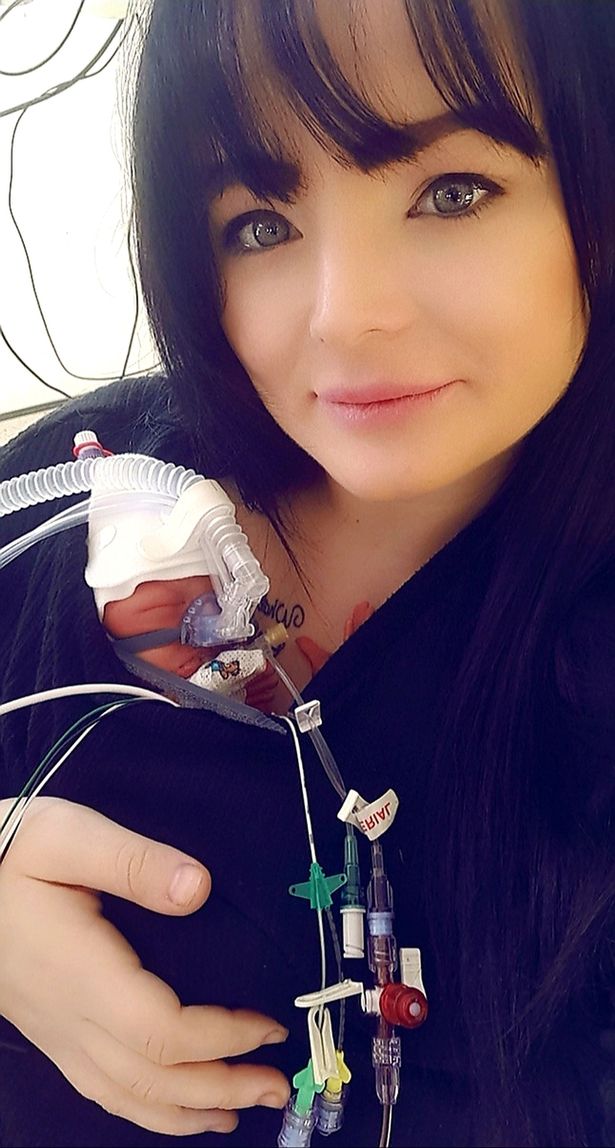 怀孕的孕妇羊水破了要生了,英国孕妇羊水破了