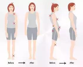 产后腰痛严重怎么办最快缓解,产后腰痛睡觉躺着痛怎么回事