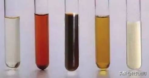 你每天撒的尿有你不知道的秘密