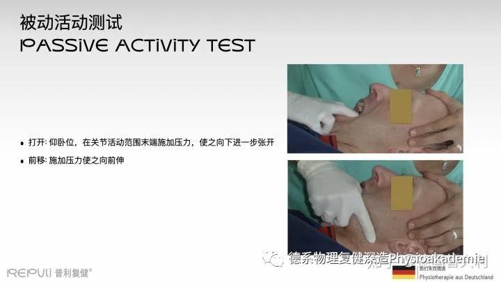 颞下颌关节紊乱综合征,颞下颌关节紊乱主要检查什么项目