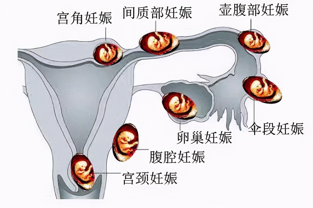 这些疾病更偏爱肥胖人群,所有疾病都是有原因的