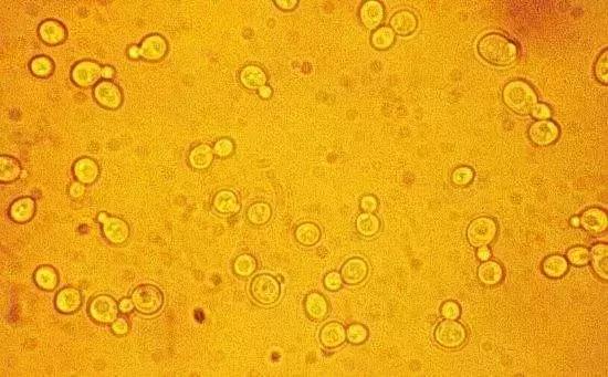 脐橙酵素肥,橙子酵素肥料