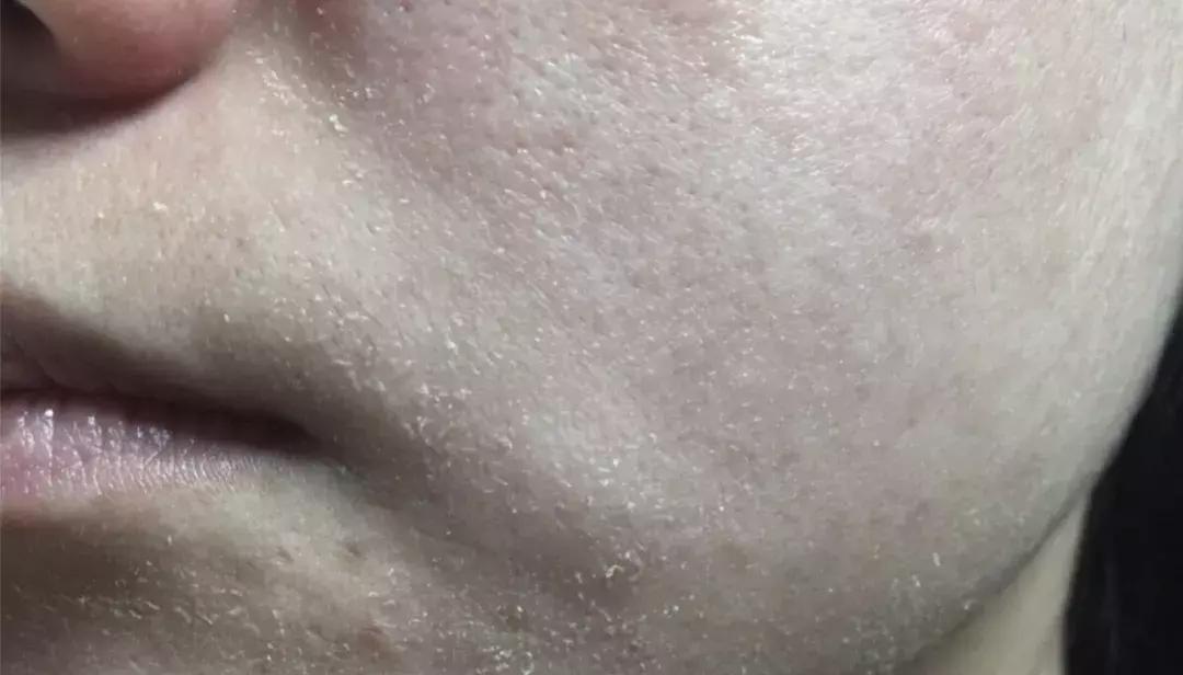 在家可以做脸部spa吗,玻尿酸深层按摩补水护理