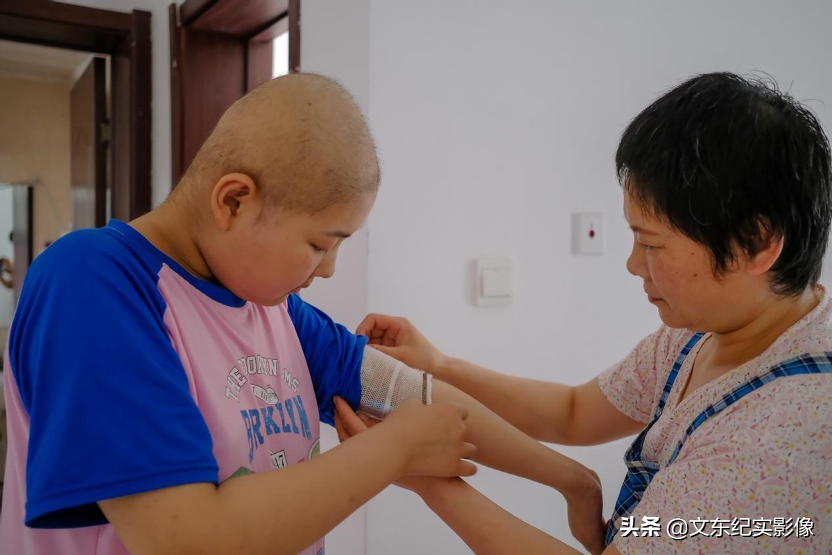 大头娃娃目前能治好吗,大头娃娃患病的原因是