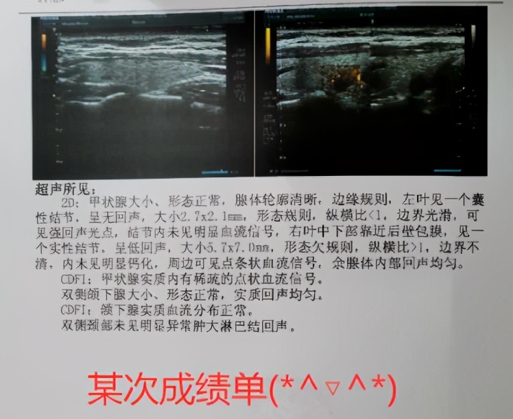 甲友心声——与甲癌的七年共生