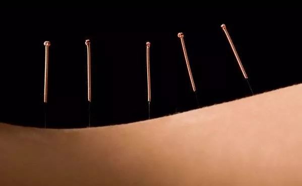 安全快速治面瘫的中医妙法,第一次面瘫施针