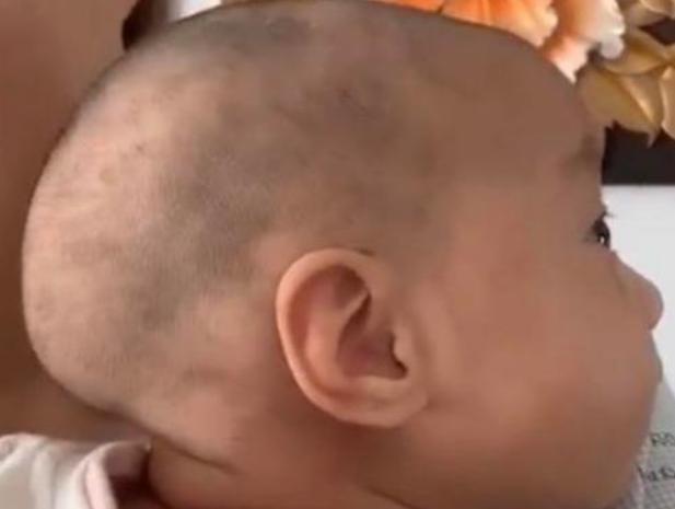 小孩后脑勺很平有什么影响吗,小孩后脑勺尖是否聪明