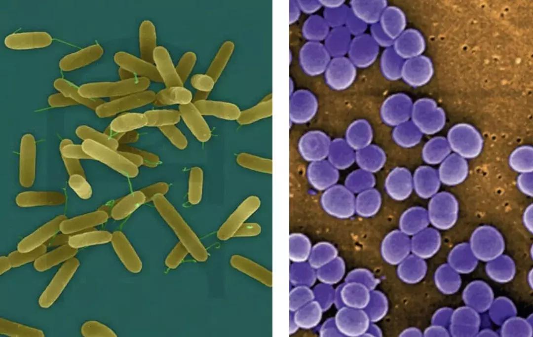 呼吸道感染的诊断和鉴别诊断,感染性监测存在的问题