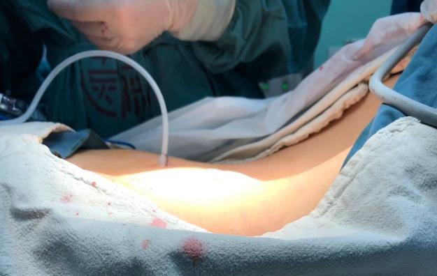 一个普通女孩的15年的变化,瘦了八十斤的亲身经历