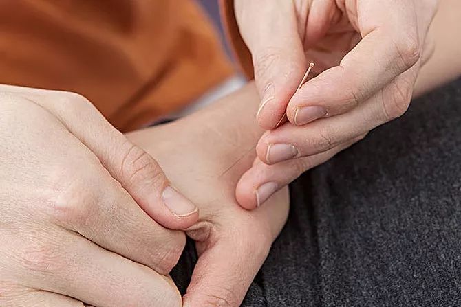 当“古针”遇上糖尿病