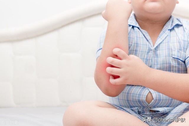 儿子额头上长了小红疙瘩,13岁男孩额头上长青春痘
