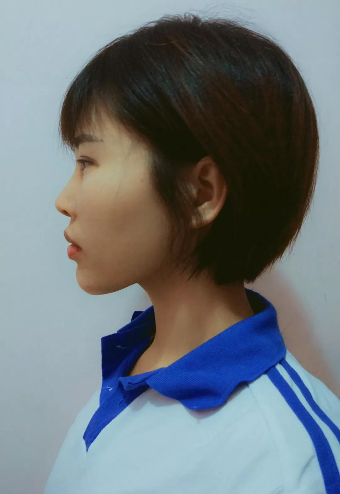 脸垮法令纹深最省钱的办法,脸垮了法令纹该怎么办