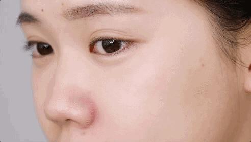 痘痘闭口全消散一周测试有效,28天祛痘