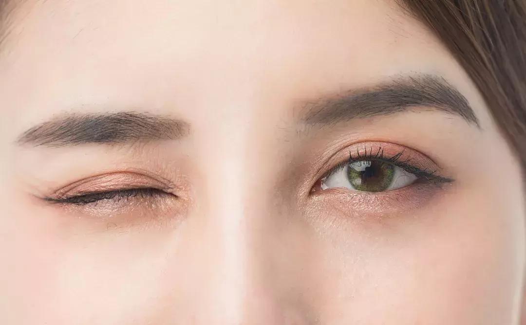 左眼皮跳财右眼皮跳灾真正含义,左眼皮和右眼皮跳代表什么含义