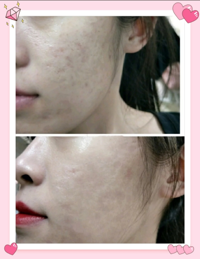 资生堂完美意境粉底液与红地球,资生堂完美意境粉底液选哪个色号