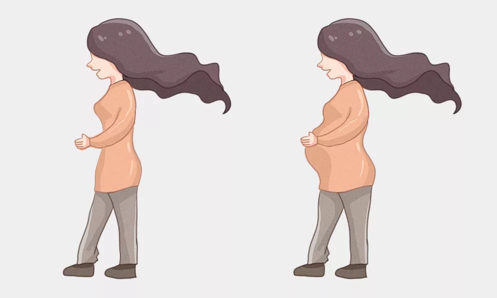 怀孕妊娠纹怎么可以彻底消除,怀孕期间出现妊娠纹怎么办