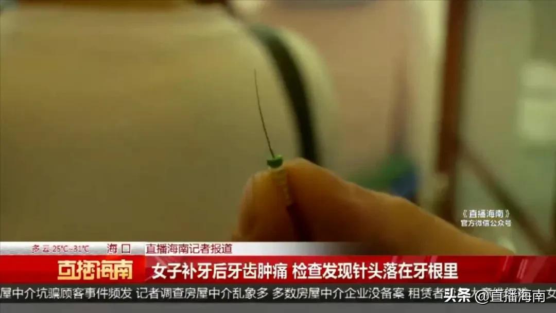 细思极恐！女子补牙后牙齿肿痛，检查发现3毫米针头落在牙根里