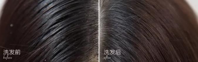 去屑洗发水深度测评六神,去屑止痒洗发水真实测评头屑多